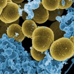 staph aureus bacteria (courtesy of Center for a Liveable Future)